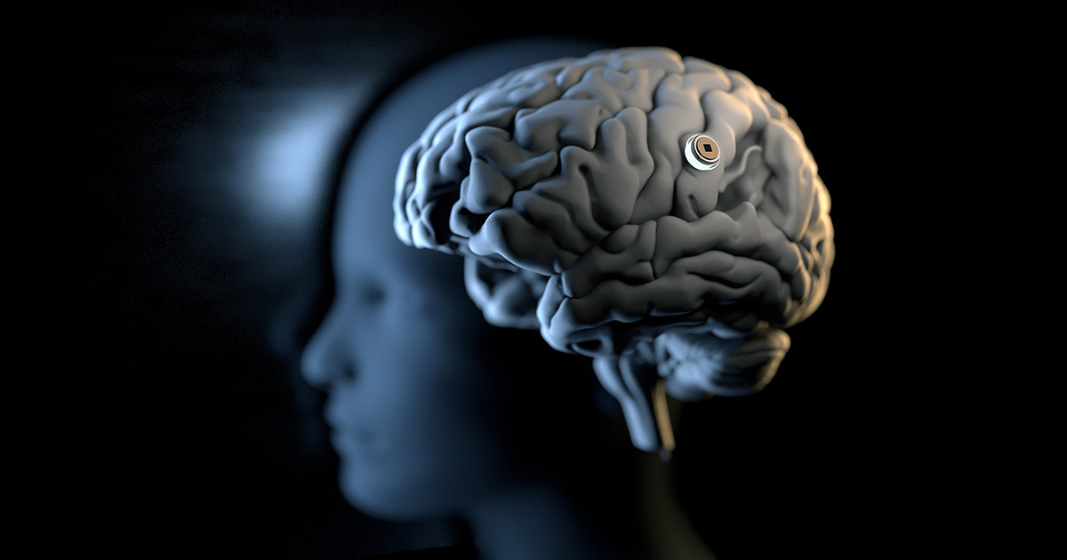 2.8 亿美元融资进一步支持马斯克的脑机接口公司 Neuralink 的人体临床试验